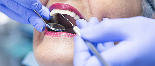 Urgent Tooth Repair in CT